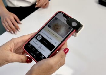 Nowoczesna diagnostyka zmian skórnych w Radomiu