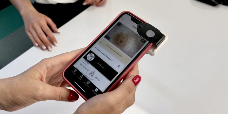 Nowoczesna diagnostyka zmian skórnych w Radomiu