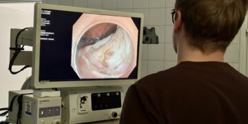 Nowoczesna medycyna bliżej pacjentów. Pionierska operacja w Mazowieckim Szpitalu Specjalistym w Radomiu